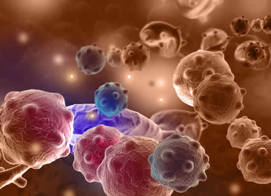 cellule cancerose metastasi