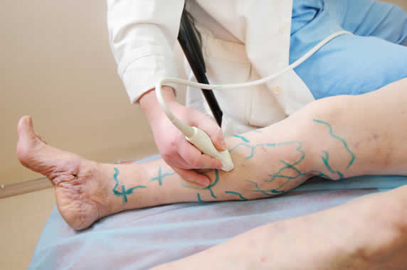 reabilitarea dupa depairea tratamentul cu perna varicoasa